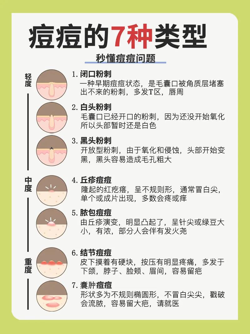 新手化妆教程17岁女孩(新手化妆教程17岁女孩)-第2张图片-美妆 新手化妆教程17岁女孩(新手化妆教程17岁女孩)-第2张图片-美妆