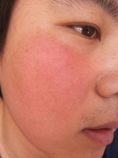 遮盖血痕化妆品推荐,遮住疤痕的化妆品-第5张图片-美妆 遮盖血痕化妆品推荐,遮住疤痕的化妆品-第5张图片-美妆