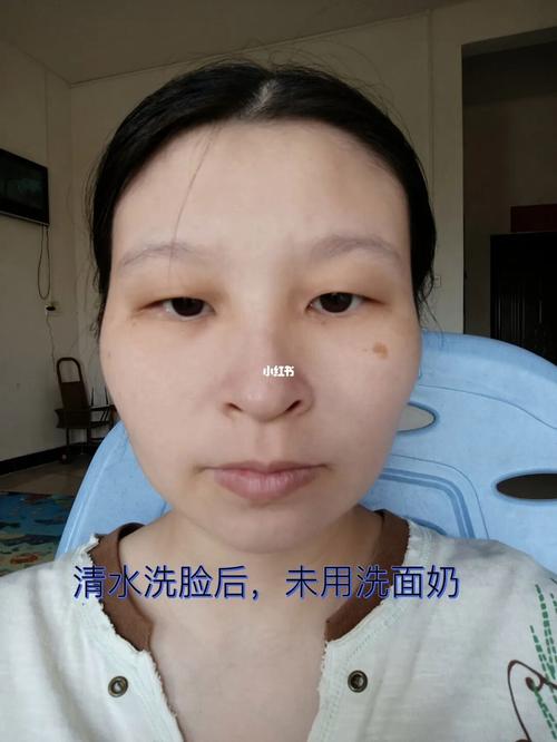 遮盖血痕化妆品推荐,遮住疤痕的化妆品-第6张图片-美妆 遮盖血痕化妆品推荐,遮住疤痕的化妆品-第6张图片-美妆