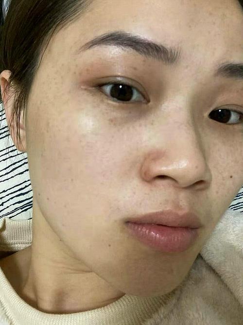 去雀斑怎么化妆教程淡妆,去雀斑怎么化妆教程淡妆的-第4张图片-美妆 去雀斑怎么化妆教程淡妆,去雀斑怎么化妆教程淡妆的-第4张图片-美妆