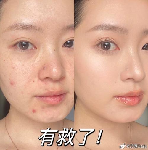化妆新手教程皮肤有点油(化妆脸太油怎么办)-第6张图片-美妆 化妆新手教程皮肤有点油(化妆脸太油怎么办)-第6张图片-美妆