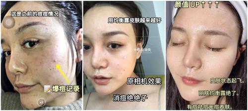 痘痘肌化妆新手教程,痘痘肌上妆步骤-第3张图片-美妆 痘痘肌化妆新手教程,痘痘肌上妆步骤-第3张图片-美妆