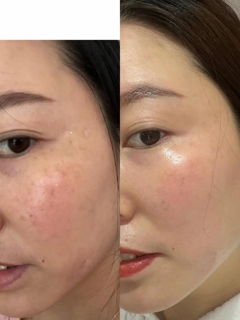 化妆无滤镜新手教程,化妆无滤镜新手教程-第3张图片-美妆 化妆无滤镜新手教程,化妆无滤镜新手教程-第3张图片-美妆