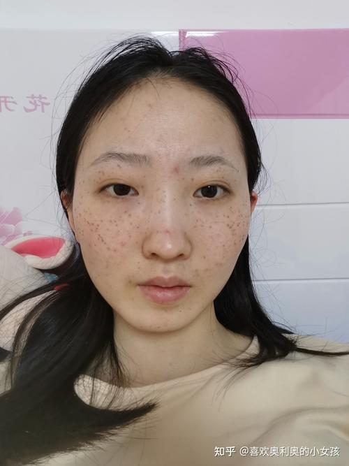 祛斑化妆教程淡妆(祛斑化妆品怎么用)-第7张图片-美妆 祛斑化妆教程淡妆(祛斑化妆品怎么用)-第7张图片-美妆
