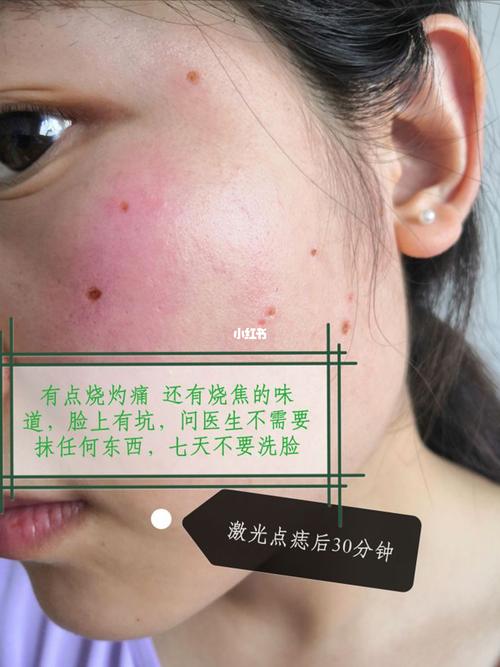 点痣化妆教程淡妆(点痣妆怎么画)-第6张图片-美妆 点痣化妆教程淡妆(点痣妆怎么画)-第6张图片-美妆