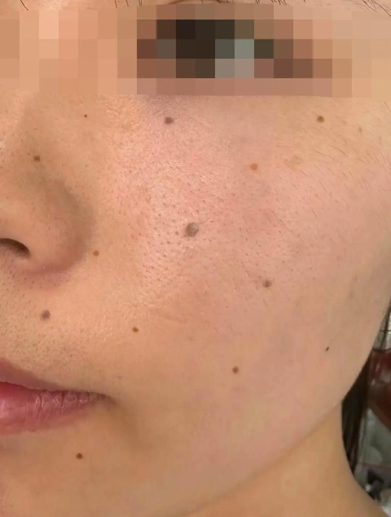 点痣化妆教程淡妆(点痣妆怎么画)-第7张图片-美妆 点痣化妆教程淡妆(点痣妆怎么画)-第7张图片-美妆
