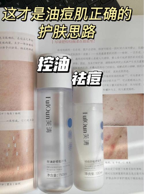 油敏痘肌化妆品推荐(油敏痘痘肌用什么护肤品)-第3张图片-美妆 油敏痘肌化妆品推荐(油敏痘痘肌用什么护肤品)-第3张图片-美妆