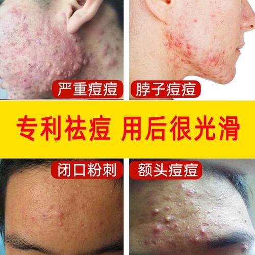 青春期化妆品推荐男生用（适合男孩子青春期用的护肤霜）