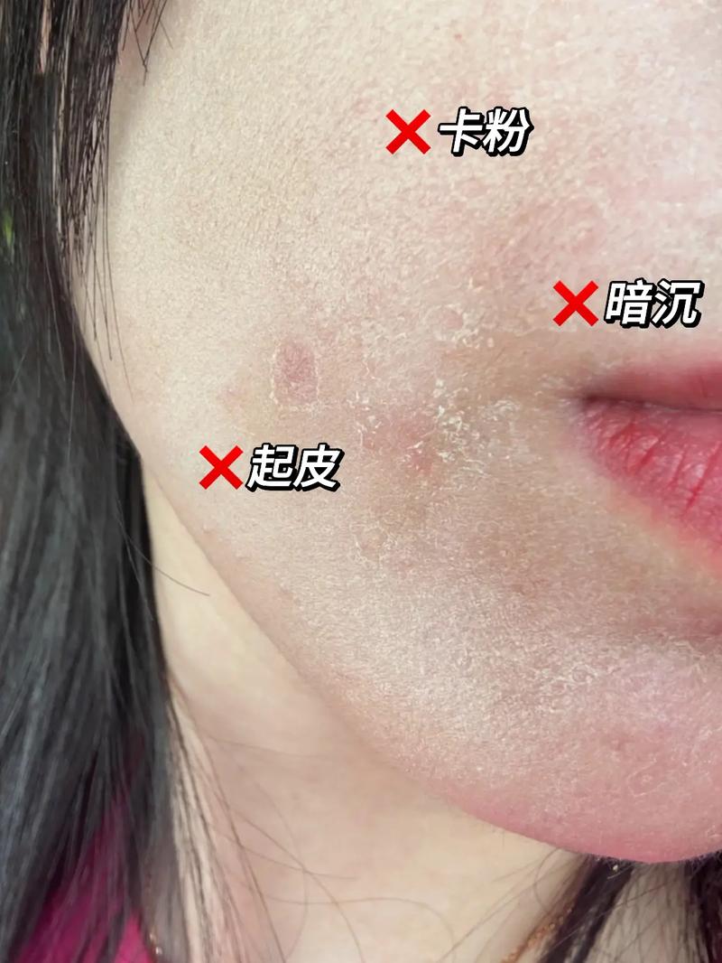 干皮新手教程化妆,干皮怎样化妆看起来很光滑-第1张图片-美妆 干皮新手教程化妆,干皮怎样化妆看起来很光滑-第1张图片-美妆