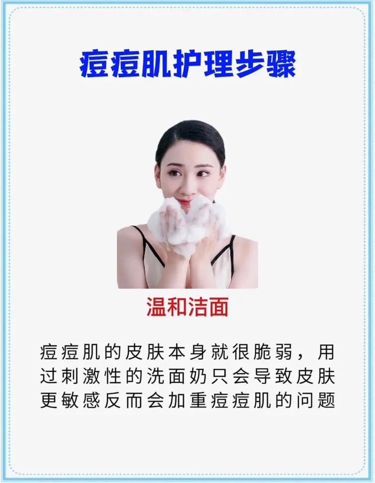 男生新手化妆痘痘教程（男生如何化妆入门）-第5张图片-美妆