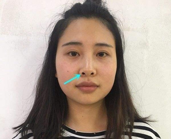 塌鼻淡妆教程日常化妆,塌鼻淡妆教程日常化妆-第7张图片-美妆
