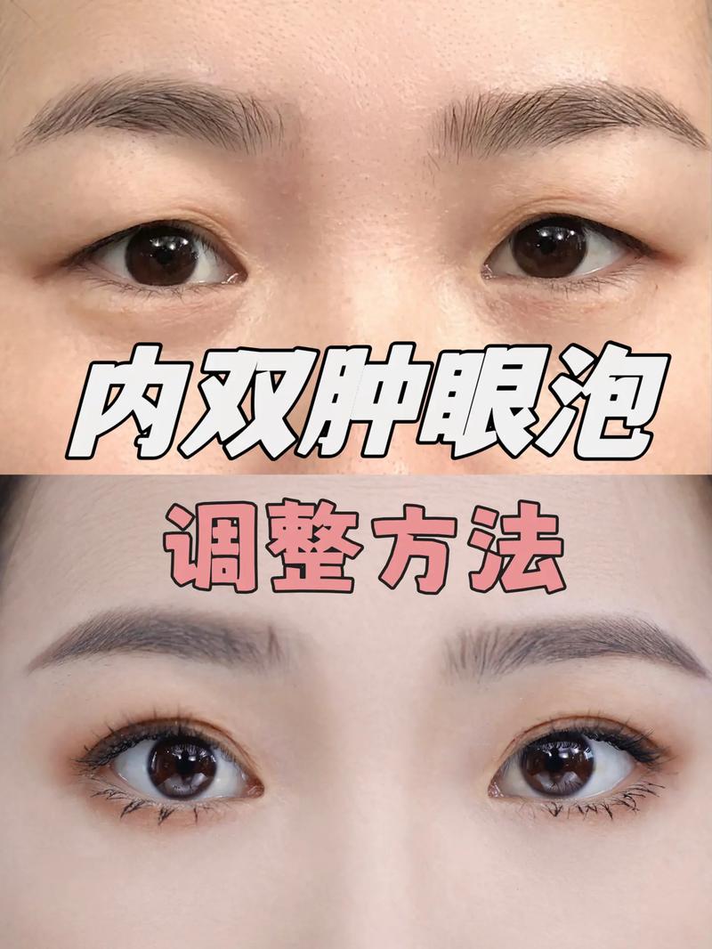 肿眼泡化妆详细教程新手(肿眼泡的眼妆怎么画)-第4张图片-美妆 肿眼泡化妆详细教程新手(肿眼泡的眼妆怎么画)-第4张图片-美妆