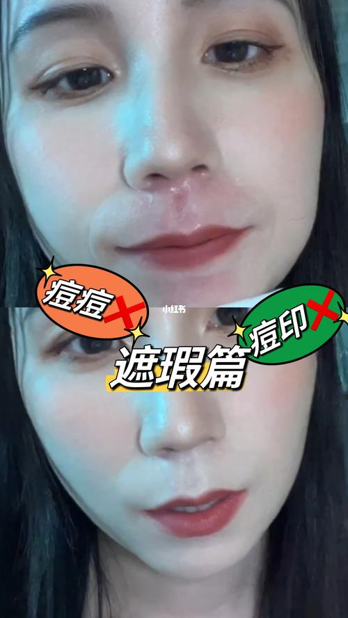 痘痘化妆步骤教程新手女生,满脸痘痘化妆视频-第2张图片-美妆 痘痘化妆步骤教程新手女生,满脸痘痘化妆视频-第2张图片-美妆