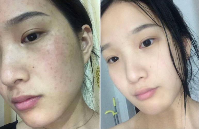 熬夜出斑化妆品推荐,熬夜长斑可以淡化嘛-第1张图片-美妆 熬夜出斑化妆品推荐,熬夜长斑可以淡化嘛-第1张图片-美妆