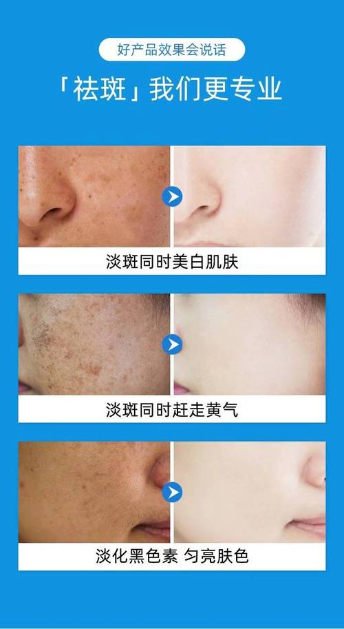 熬夜出斑化妆品推荐,熬夜长斑可以淡化嘛-第2张图片-美妆 熬夜出斑化妆品推荐,熬夜长斑可以淡化嘛-第2张图片-美妆
