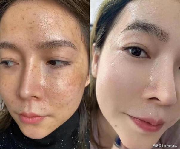 遮斑化妆品套装推荐女,遮斑效果好的-第2张图片-美妆 遮斑化妆品套装推荐女,遮斑效果好的-第2张图片-美妆