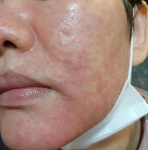 淡妆口罩化妆教程,口罩妆容-第8张图片-美妆 淡妆口罩化妆教程,口罩妆容-第8张图片-美妆