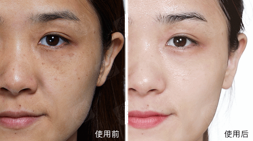 斑点遮瑕化妆品推荐女士(斑点遮瑕膏什么牌子好)-第6张图片-美妆 斑点遮瑕化妆品推荐女士(斑点遮瑕膏什么牌子好)-第6张图片-美妆