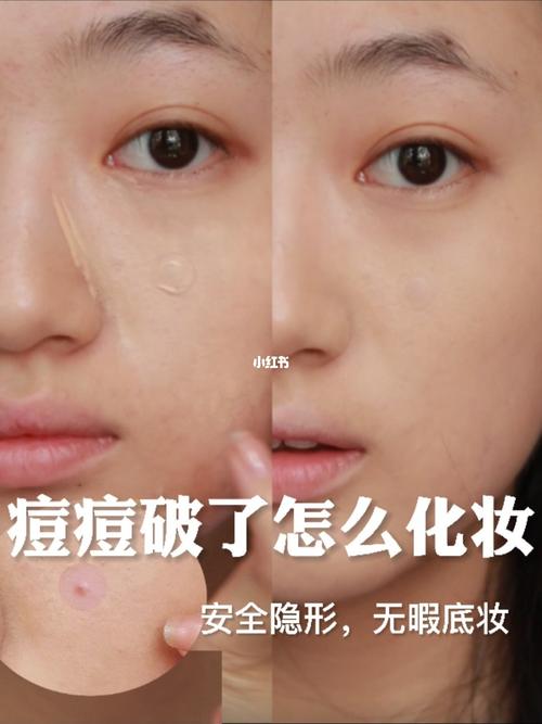 新手长痘化妆教程,长痘如何化妆-第5张图片-美妆 新手长痘化妆教程,长痘如何化妆-第5张图片-美妆