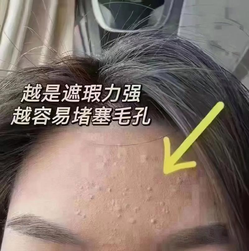 新手学化妆教程痘痘肌(新手小白学化妆)-第7张图片-美妆 新手学化妆教程痘痘肌(新手小白学化妆)-第7张图片-美妆