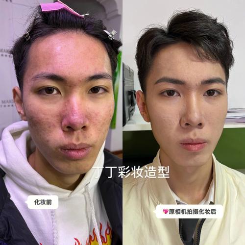 油痘肌化妆教程新手(油痘肌化妆步骤)-第3张图片-美妆 油痘肌化妆教程新手(油痘肌化妆步骤)-第3张图片-美妆