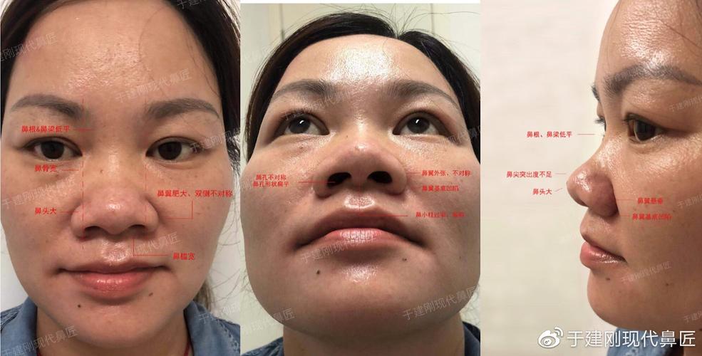 鼻头多肉化妆教程新手,鼻头多肉化妆教程新手图片