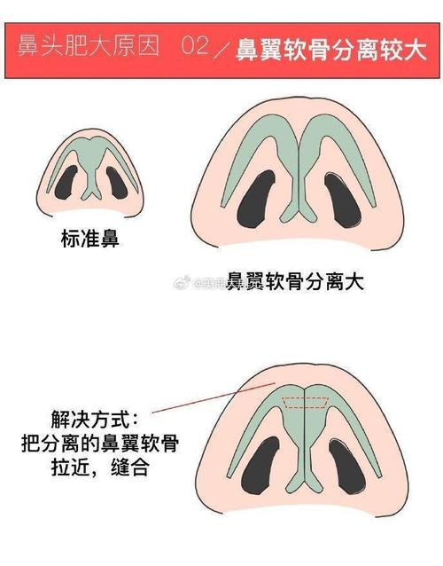 鼻头多肉化妆教程新手,鼻头多肉化妆教程新手图片-第6张图片-美妆 鼻头多肉化妆教程新手,鼻头多肉化妆教程新手图片-第6张图片-美妆