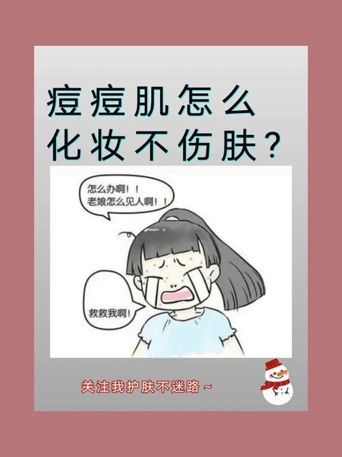 化妆新手教程痘痘肌(痘痘化妆挑战)-第4张图片-美妆 化妆新手教程痘痘肌(痘痘化妆挑战)-第4张图片-美妆