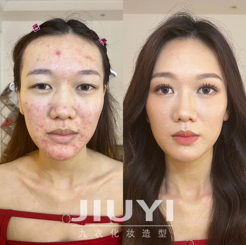 化妆新手教程痘痘肌(痘痘化妆挑战)-第7张图片-美妆 化妆新手教程痘痘肌(痘痘化妆挑战)-第7张图片-美妆