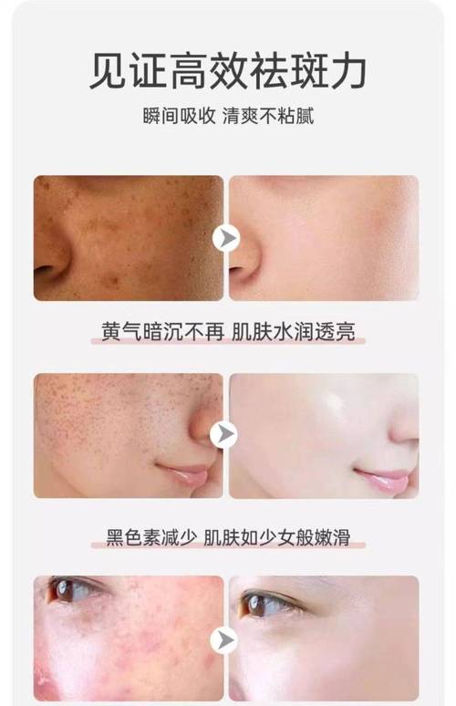 新手斑点化妆教程推荐,斑点妆画法-第3张图片-美妆 新手斑点化妆教程推荐,斑点妆画法-第3张图片-美妆