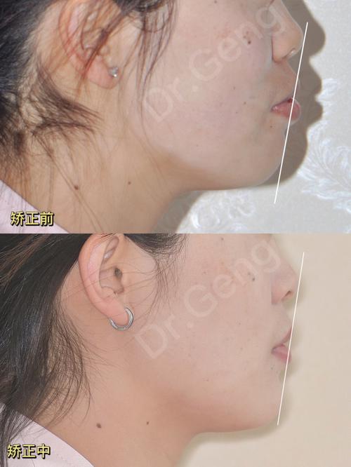新手化妆入门教程凸嘴（化妆嘴型照片）