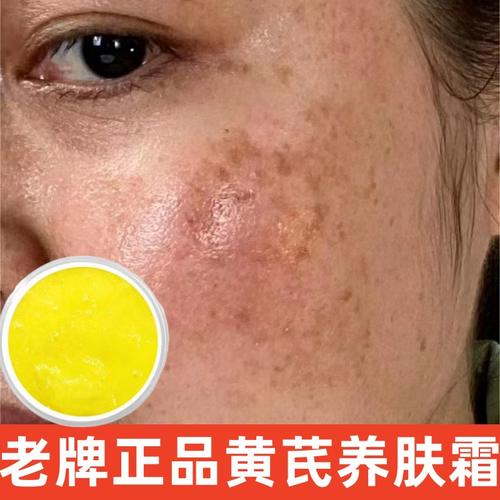 黑黄油皮化妆品推荐女生,黑黄油皮用什么护肤品-第6张图片-美妆 黑黄油皮化妆品推荐女生,黑黄油皮用什么护肤品-第6张图片-美妆