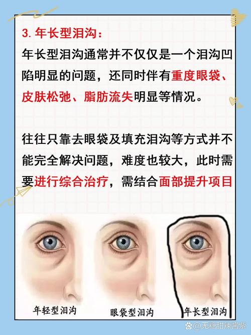 去泪沟的顶级化妆品推荐(去泪沟的顶级化妆品推荐有哪些)-第3张图片-美妆 去泪沟的顶级化妆品推荐(去泪沟的顶级化妆品推荐有哪些)-第3张图片-美妆