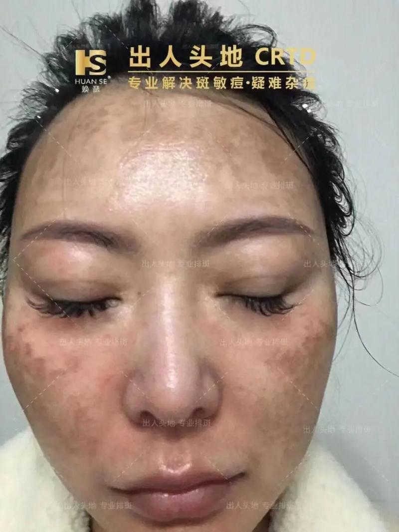 化妆品修复大神推荐的产品(修复化妆品多少钱)-第2张图片-美妆 化妆品修复大神推荐的产品(修复化妆品多少钱)-第2张图片-美妆