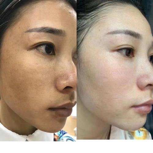 有斑淡妆化妆教程,有斑如何化妆-第2张图片-美妆 有斑淡妆化妆教程,有斑如何化妆-第2张图片-美妆