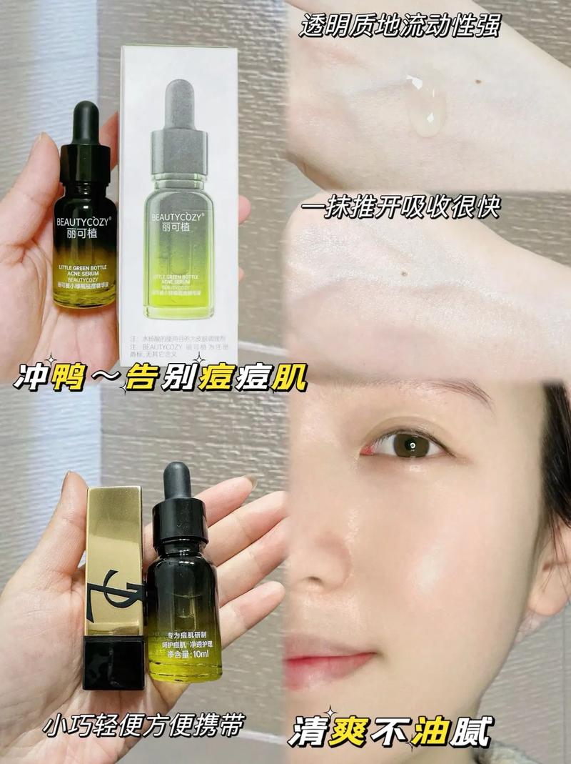 适合痘痘油皮的化妆品推荐(适合油皮痘痘肌的护肤品推荐品牌)-第6张图片-美妆 适合痘痘油皮的化妆品推荐(适合油皮痘痘肌的护肤品推荐品牌)-第6张图片-美妆